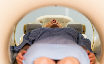 A sugárkezelés miatt kialakuló fáradtságérzet egyik okát fedezték fel magyar kutatók